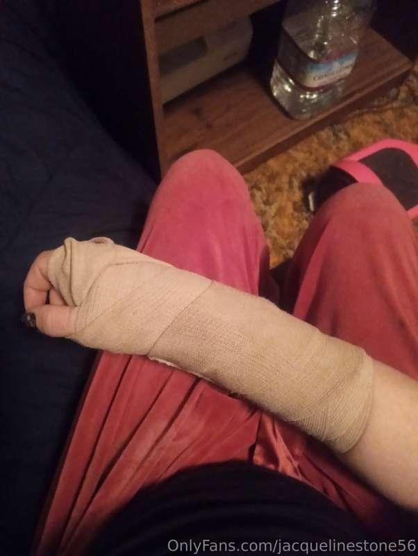 Definitely broke my wrist on a hover board tonight 😭 