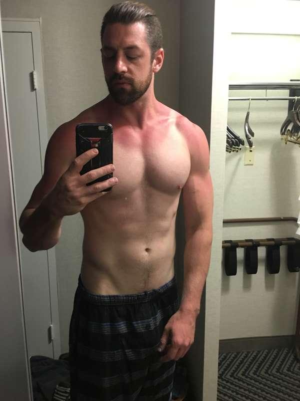 This trip has not been gentle on my fair skin