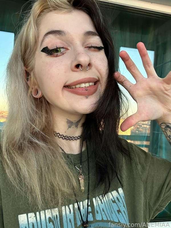 anemiaa image #0