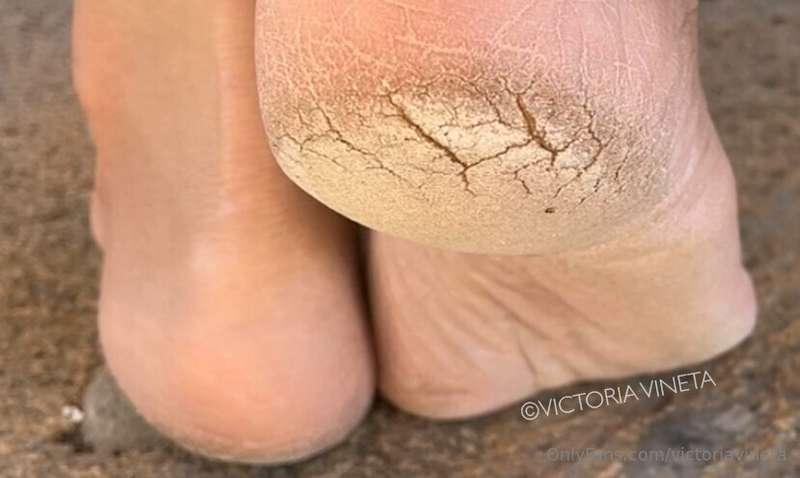 So rough soles, so big feet, so cracked heels, so much space..
