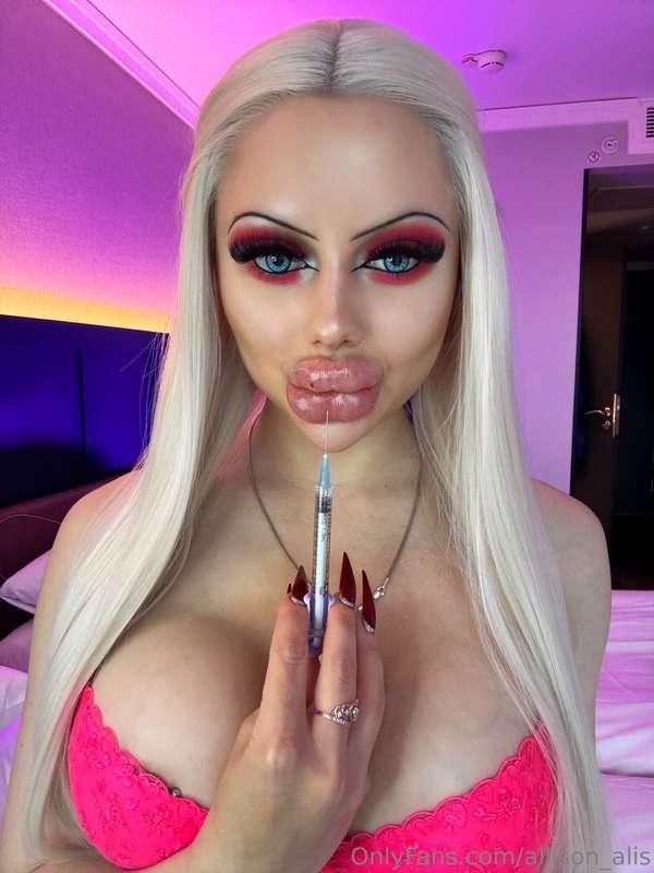 Lips augmentation is my passion 🩷💖