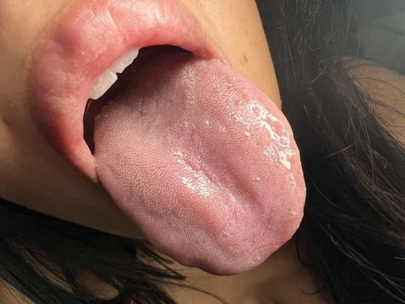 Tongue picture for you