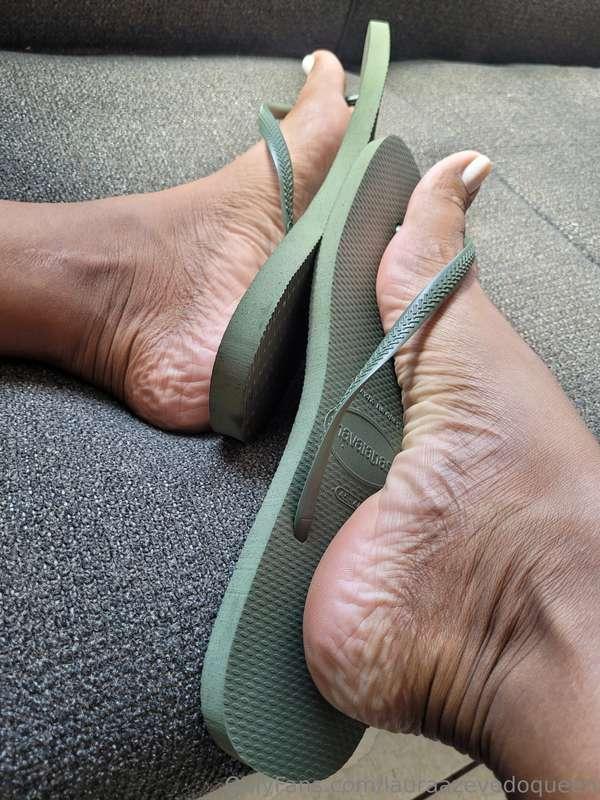 My wonderful wrinkles!