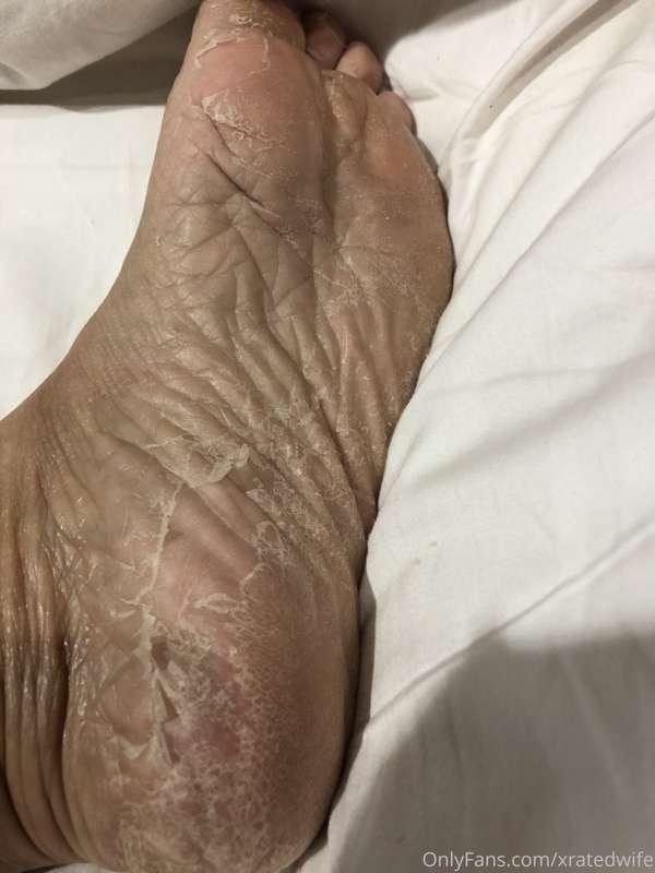 I’m doing one of those babies soft peels on my feet so foot ..