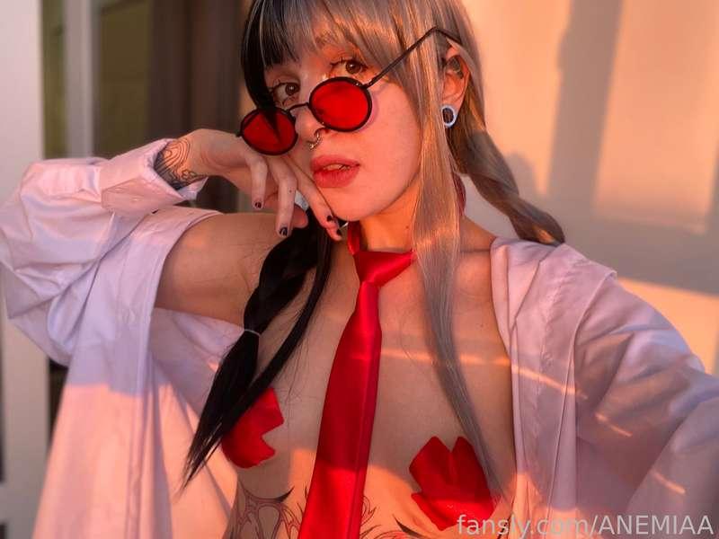 anemiaa image #3