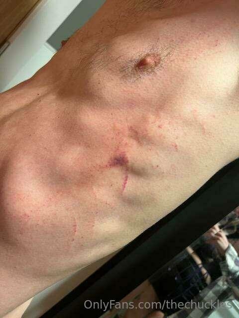 thechuckles image #0