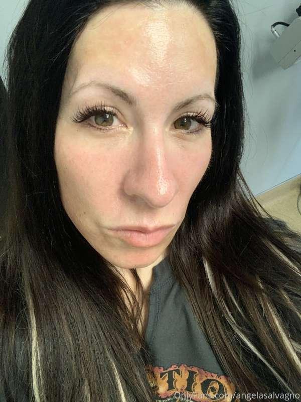 Hello! My results. Wow I look refreshed!