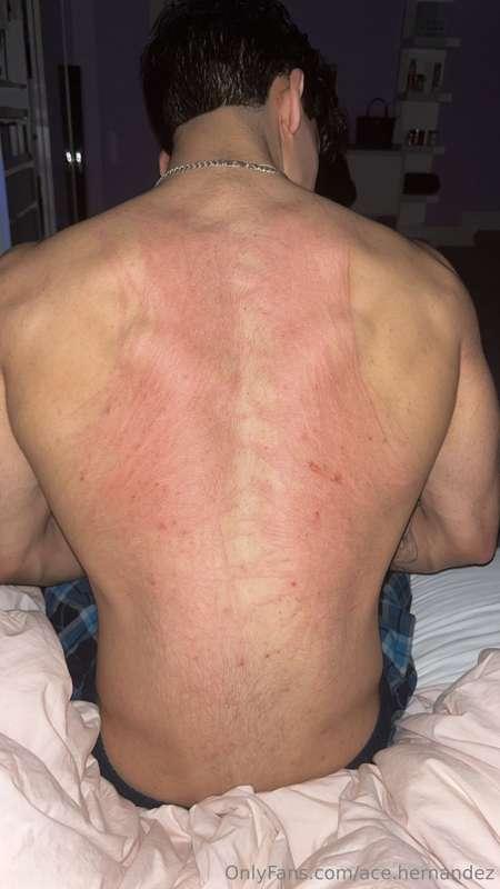 ace.hernandez image #0