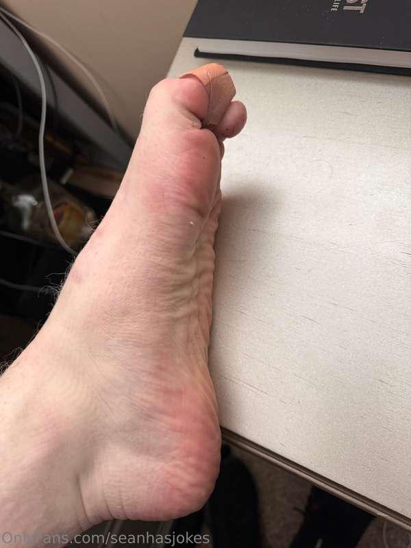 I hear my toe😢🥹🥃