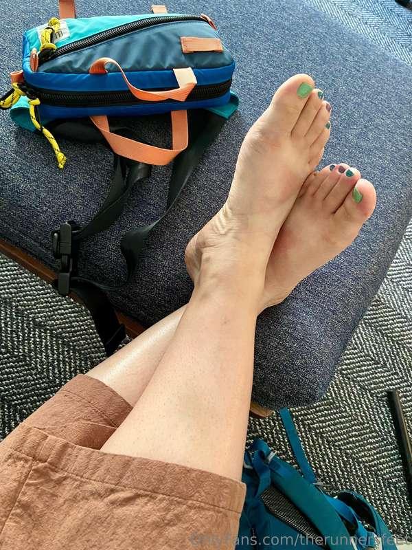 Accidental sandal sunburn.