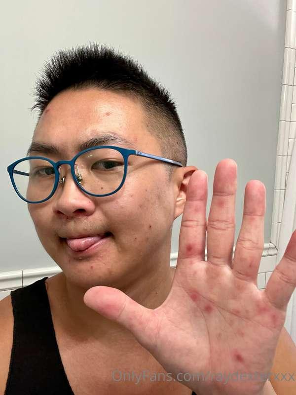 🚨 HEALTH UPDATE 🚨

Hey, everyone. So, as you all know from m..