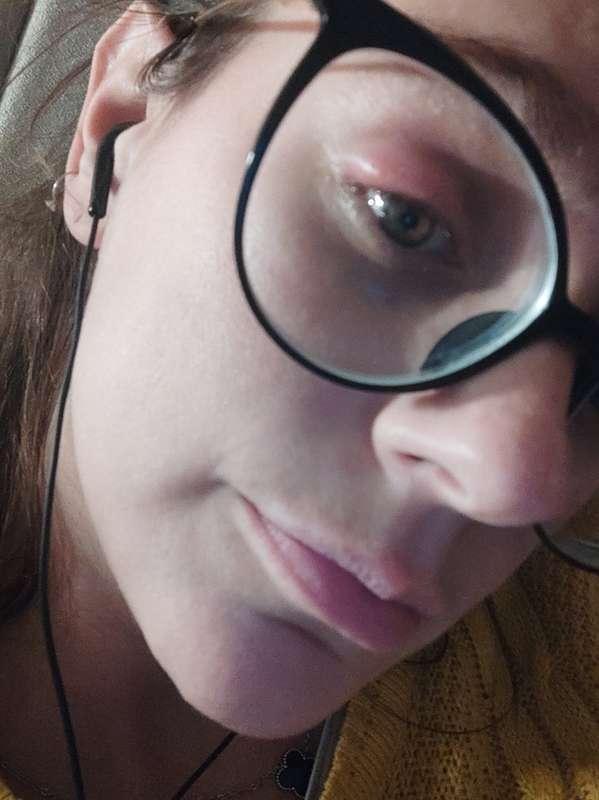 Would you help me go through the hard times of having an eye..