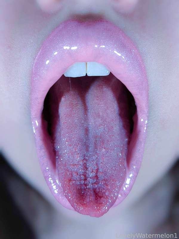 lovelywatermelon1 image #8