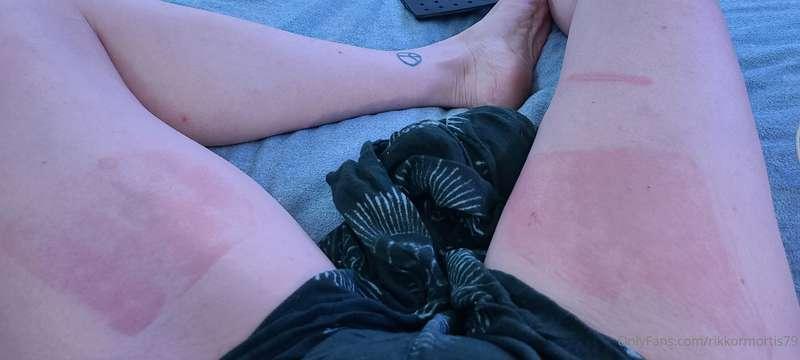 Fun playtime with Daddy last night!!! #rope #bitemarks #brui..