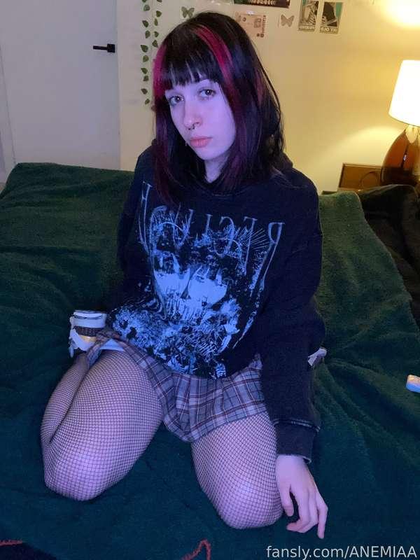 anemiaa image #2