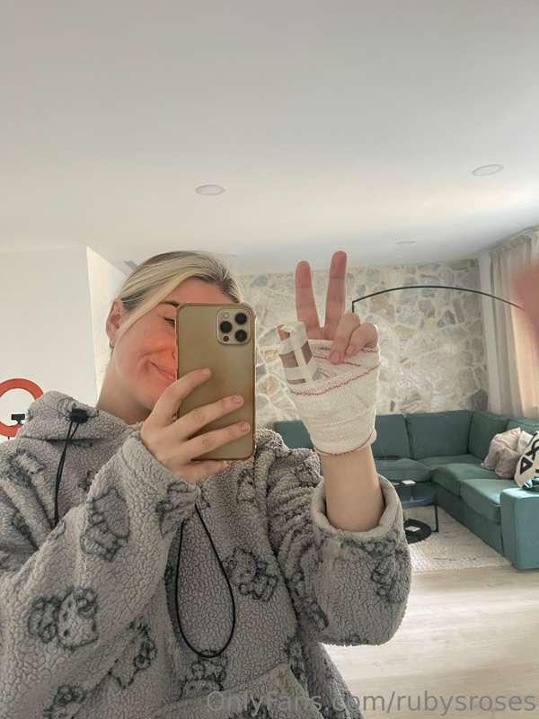 I broke my thumb 😭😭😭 please bear with me getting back to you..