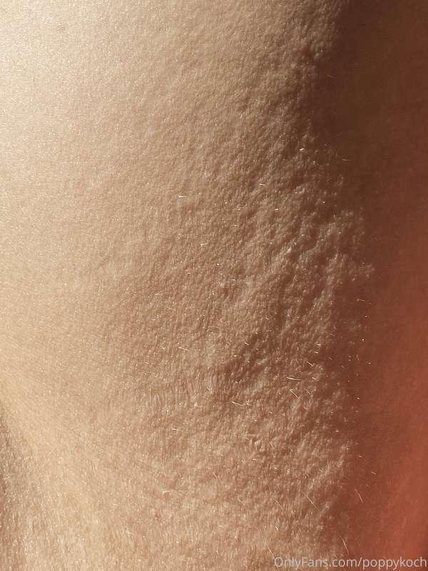 Upper thigh skin, relaxed.
