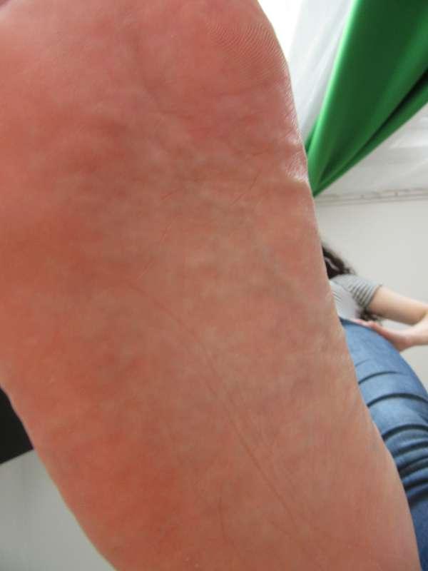 neolasoles image #2