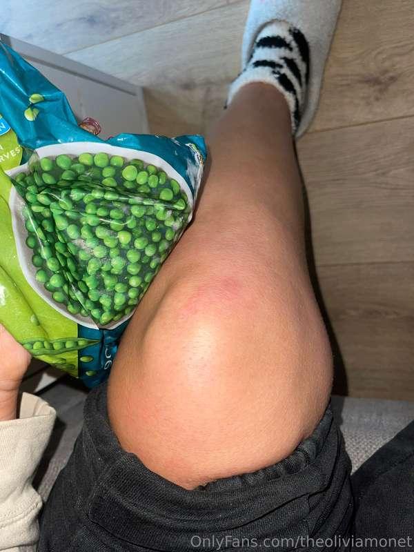 I took a really nasty fall from my massage bed directly onto..