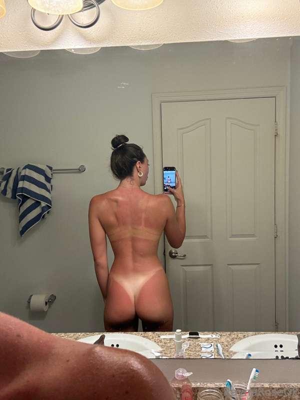 so burntt 