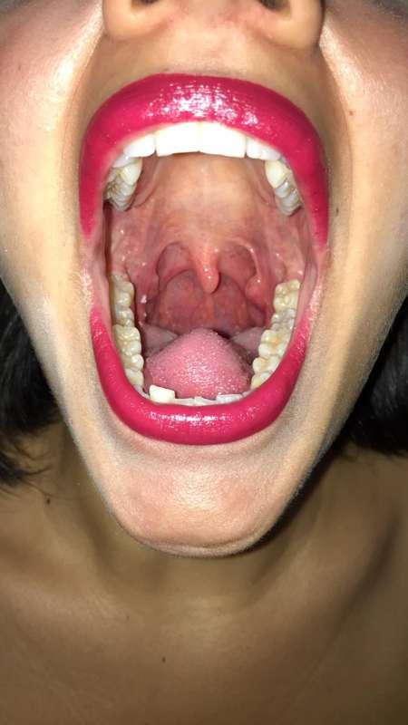 Do you have a favorite throat?