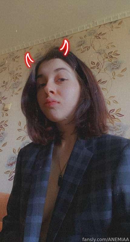 anemiaa image #1