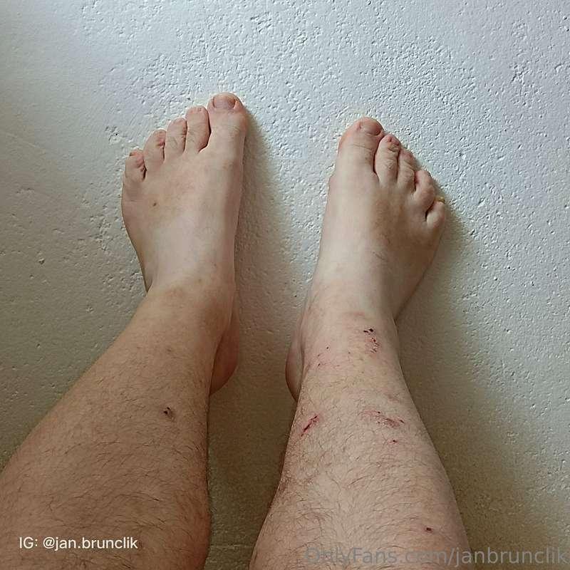 My legs