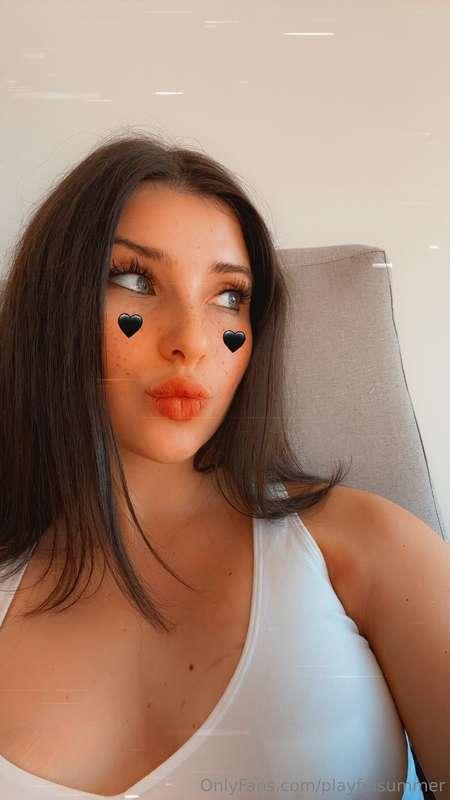 I'm still recovering from my surgery! Day 3❤️‍🩹🤍