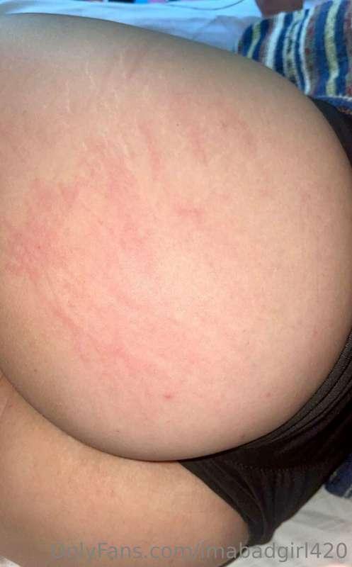i love being spanked so hard it leaves evidence 😮‍💨 …do you ..
