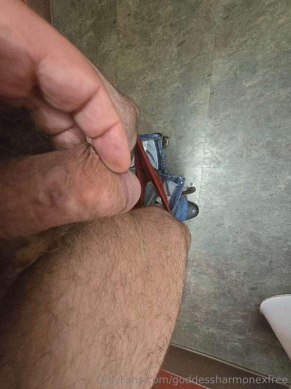 I wish electric burns showed up better… Maybe I just need to..