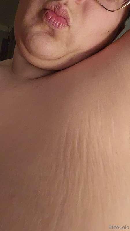 My chest stretch marks are really coming in hehe