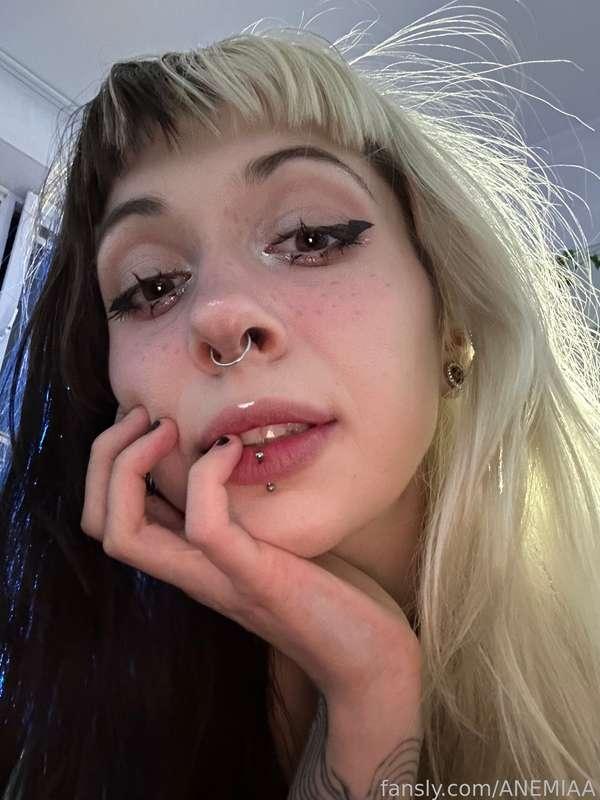 anemiaa image #2