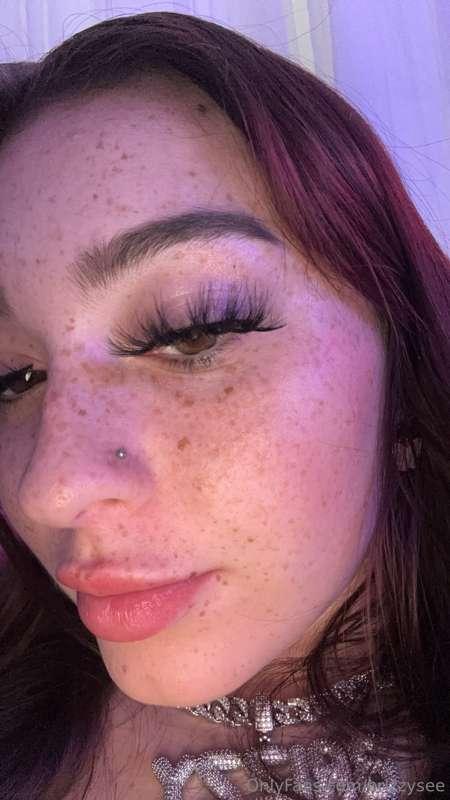 u like my freckles ?