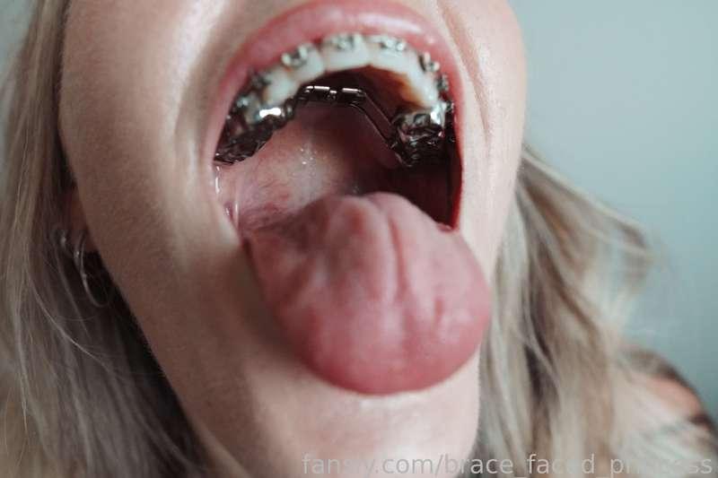 brace_faced_princess image #2