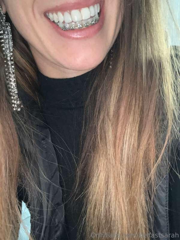 Bye bye metal mouth, you’ve been cute af.