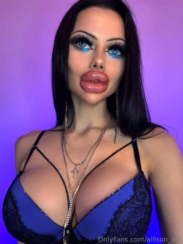Time for a new lips injection 💉 
Tip me and get extra sale f..