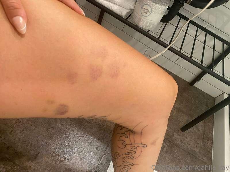 I‘ve been fucking so much in the past week, I am bruised all..