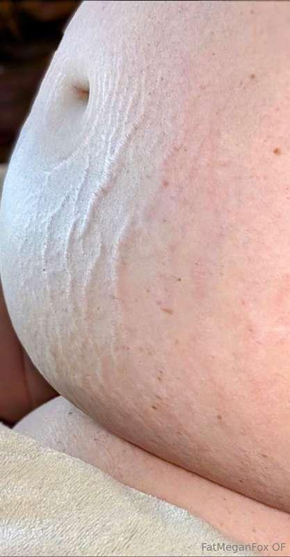 I bloated big time last night and sheesh my stretchmarks are..