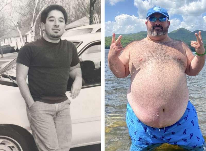 Before and After