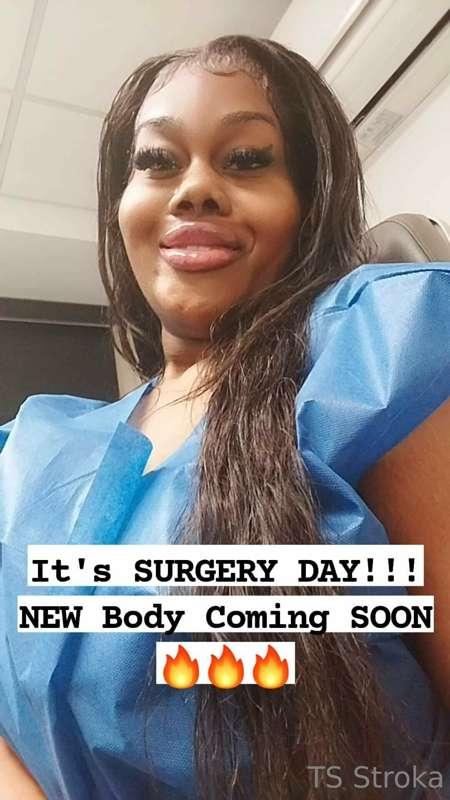 My surgery came out 🔥🔥🔥 My Hips & ASS are HUGE 😍. I was cryi..