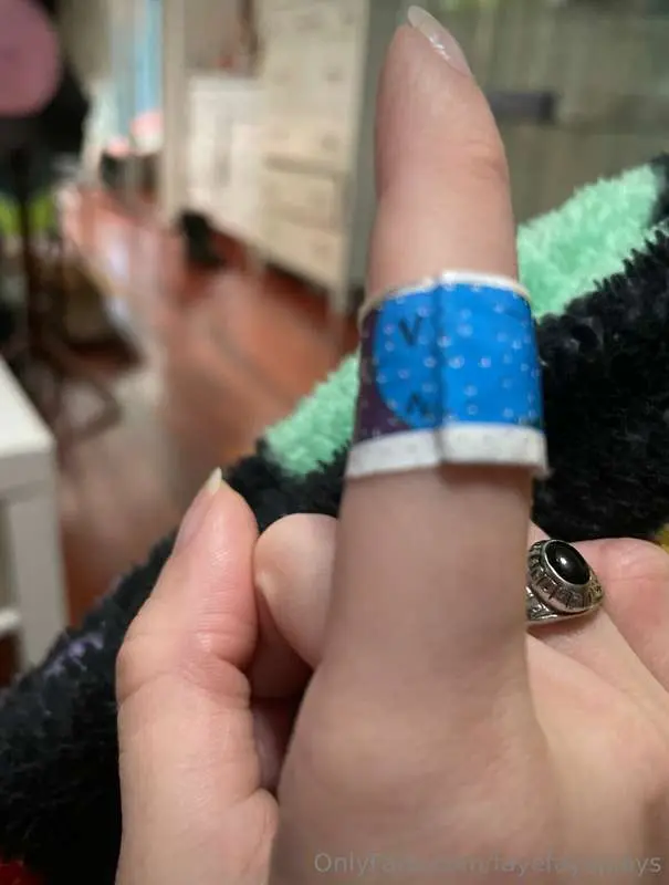 I got a cute wobbuffet bandaid for my little cut. But you sh..