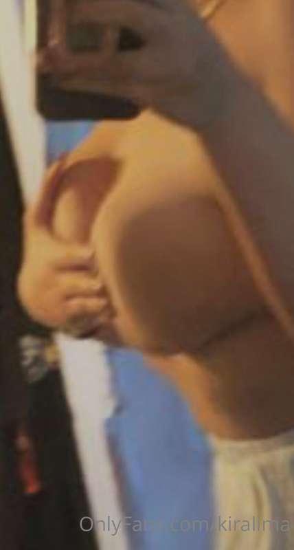 Poor quality for the aesthetic