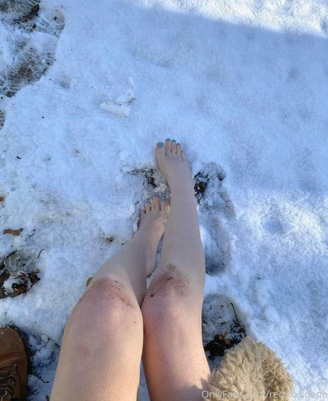 snowy toes & soles 🦶 ❄️