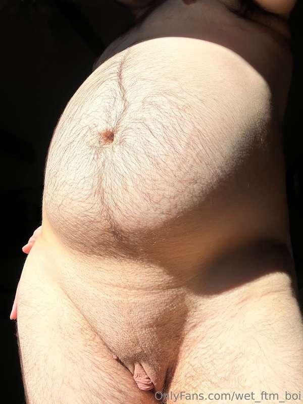 the sun highlights my stretch marks so beautifully🤩😍🫃🏻