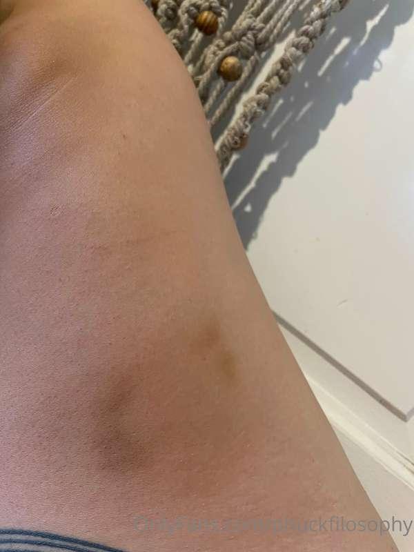 I looooove love bruises 😍 guess what this one was from?