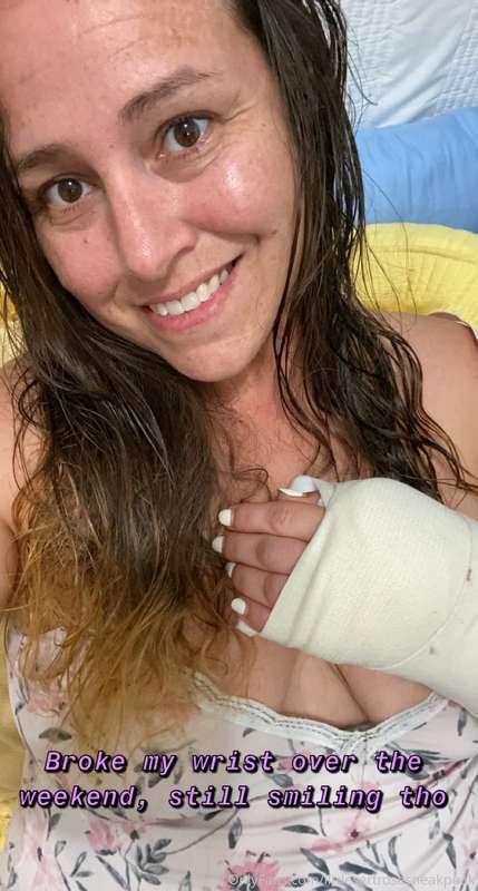 Broken wrist won’t break my smile😁💕