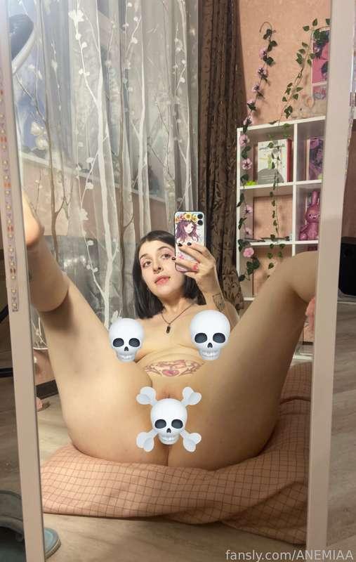 anemiaa image #0
