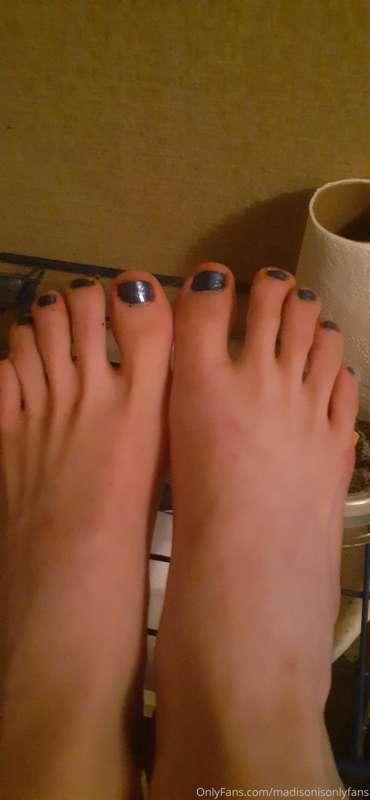 Purple toes