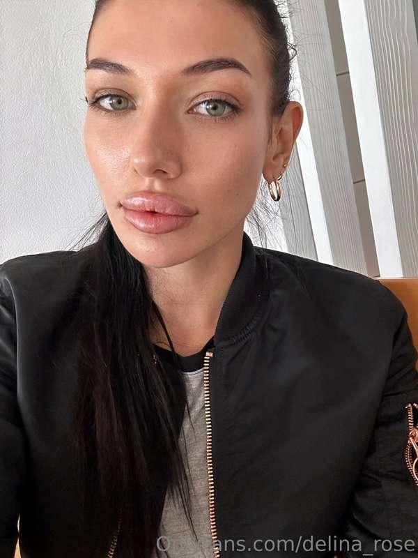 Hello 👁️👄👁️ your swollen baby is back!  (Just got my lips do..