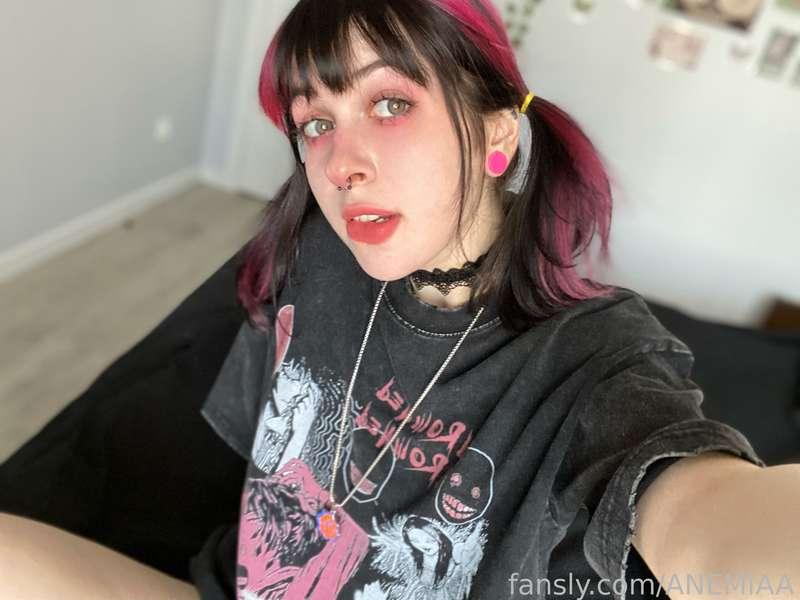 anemiaa image #2